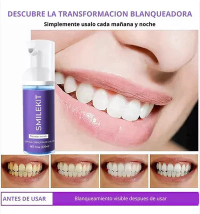 SMILE KIT K - Blanqueador Dental V32